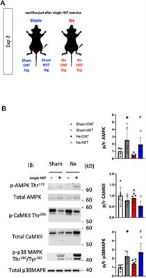 High-intensity interval training using electrical stimulation ameliorates muscle fatigue in chronic kidney disease-related cachexia by restoring mitochondrial respiratory dysfunction